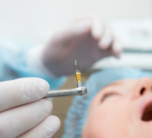 Dentist holding a dental implant right before surgical placement